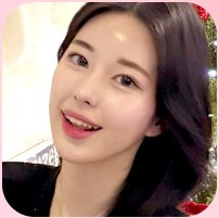 리얼수술후기 콜라주 오른쪽 가운데 — 웃는 여성 셀카