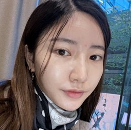 #쌍꺼풀절개 #눈매교정 BEFORE