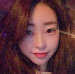 #눈재수술 #맞춤코 #V리프팅 BEFORE