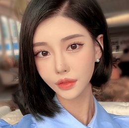 #코재수술 #이마필러 #V라인리프팅 AFTER